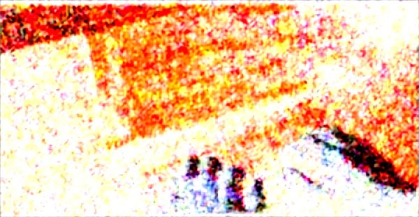 Sécheresse intime : solutions naturelles et apaisantes à découvrir